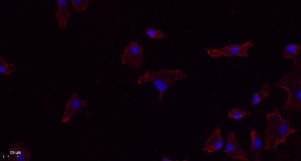 a05465 eif2ak1 primary antibodies if testing 1