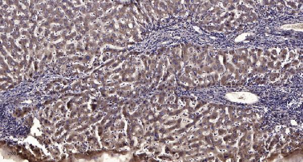 a05465 eif2ak1 primary antibodies ihc testing 5
