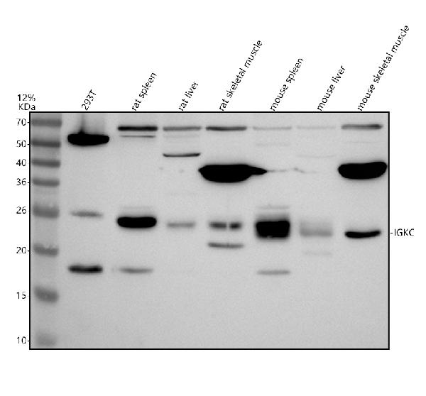 Western blot analysis of Ig Kappa light chain/IGKC using anti-Ig Kappa light chain/IGKC antibody (A05470-1)