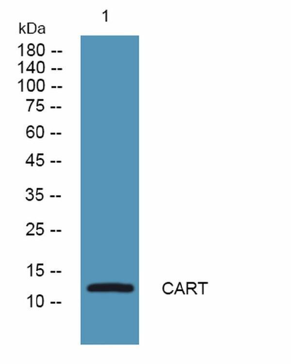 Western blot analysis of lysates from K562 cells, primary antibody was diluted at 1:1000, 4°C over night