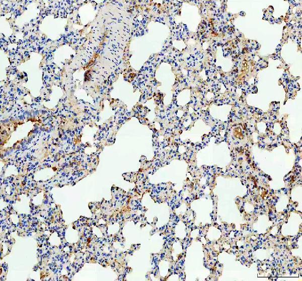 a05472 1 tspan12 primary antibodies ihc testing 3