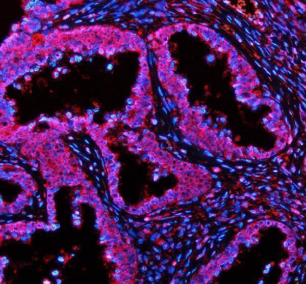 a05479 1 plin5 primary antibodies if testing 1