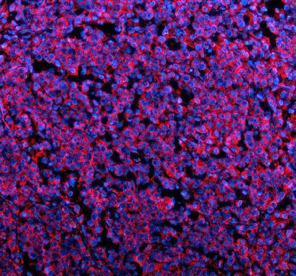 a05479 1 plin5 primary antibodies if testing 2