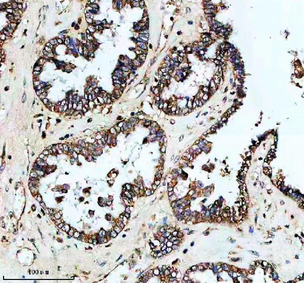 IHC analysis of PLIN5 using anti-PLIN5 antibody (A05479-1)
