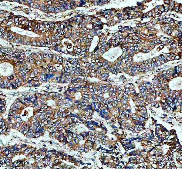 IHC analysis of PLIN5 using anti-PLIN5 antibody (A05479-1)