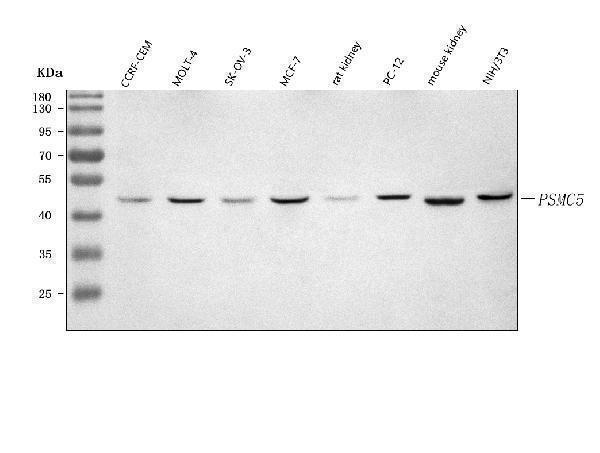  Western blot analysis of PSMC5 using anti-PSMC5 antibody (A05480-1)