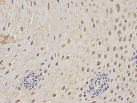 Immunofluorescence analysis of MCF-7 cells using PSMC5 antibody 