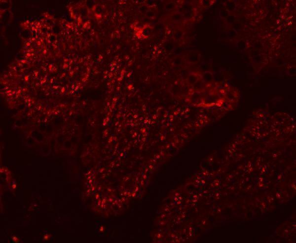 a05483 1 sf3a1 primary antibodies if testing 11