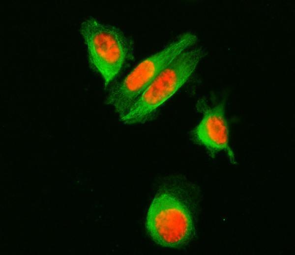 a05483 1 sf3a1 primary antibodies if testing 12