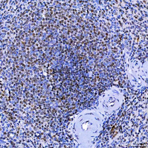  IHC analysis of SF3A1 using anti-SF3A1 antibody (A05483-1)