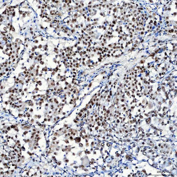 a05483 1 sf3a1 primary antibodies ihc testing 6