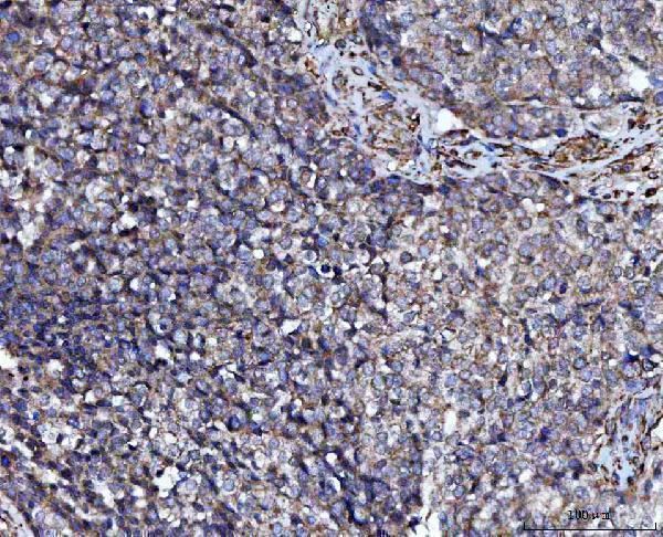  IHC analysis of PRMT7 using anti-PRMT7 antibody (A05485-2)