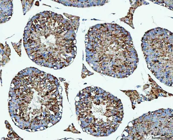  IHC analysis of PRMT7 using anti-PRMT7 antibody (A05485-2)
