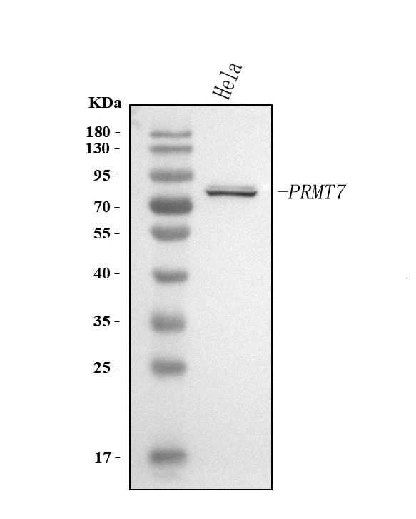  Western blot analysis of PRMT7 using anti-PRMT7 antibody (A05485-2)