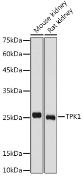 Western blot analysis of extracts of various cell lines, using TPK1 antibody  at 1:1000 dilution