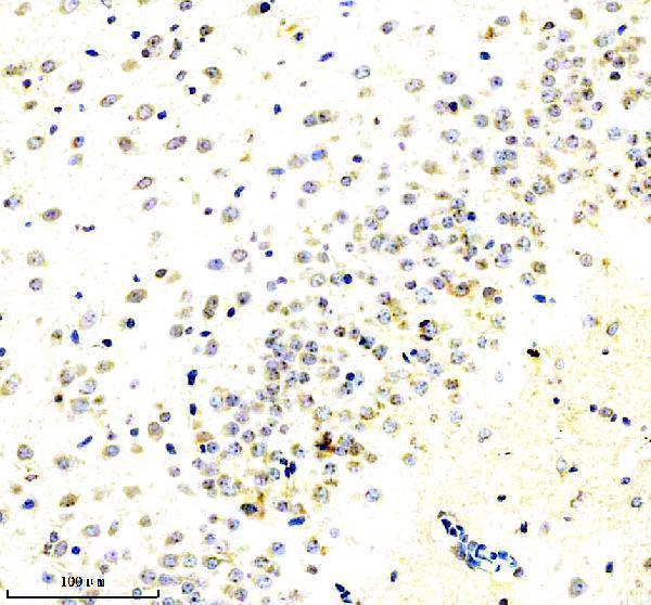  IHC analysis of RIM1/RIMS1 using anti-RIM1/RIMS1 antibody (A05490)