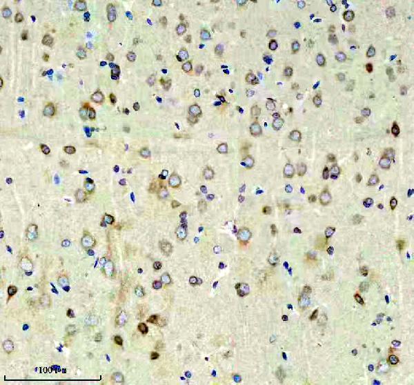  IHC analysis of RIM1/RIMS1 using anti-RIM1/RIMS1 antibody (A05490)