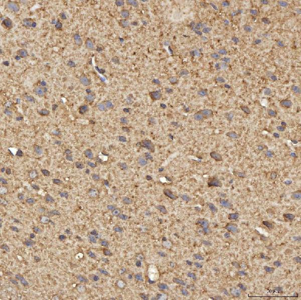  IHC analysis of SPTBN2 using anti-SPTBN2 antibody (A05492)