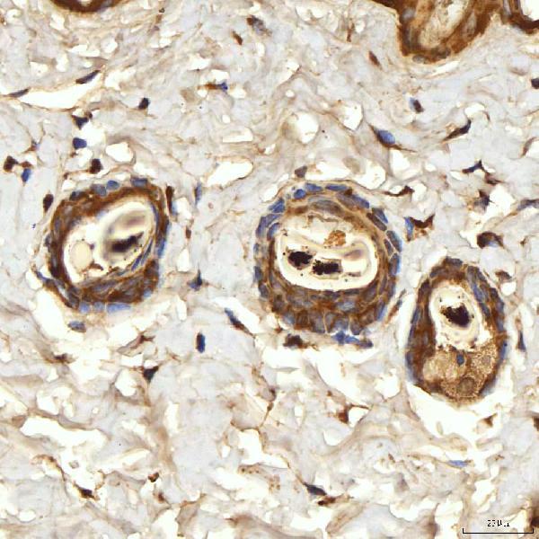 a05492 sptbn2 primary antibodies ihc testing 3
