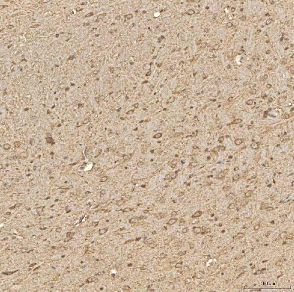 a05492 sptbn2 primary antibodies ihc testing 4