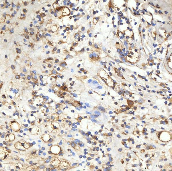 a05492 sptbn2 primary antibodies ihc testing 5
