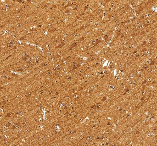IHC analysis of SPTBN2 using anti-SPTBN2 antibody (A05492)