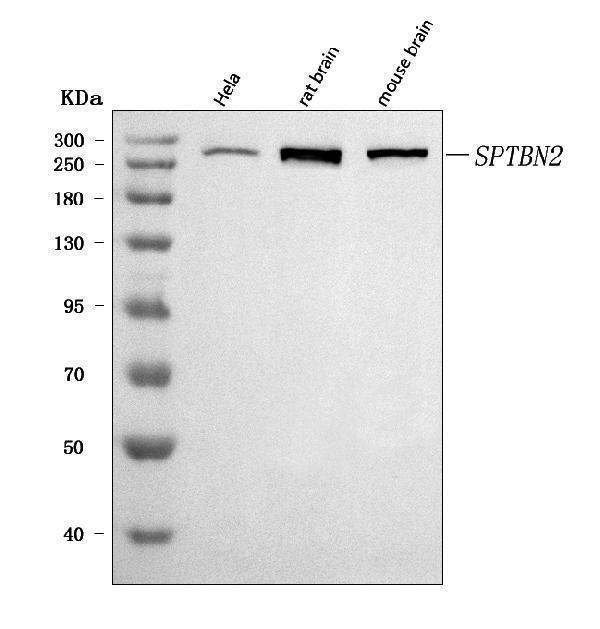  Western blot analysis of SPTBN2 using anti-SPTBN2 antibody (A05492)
