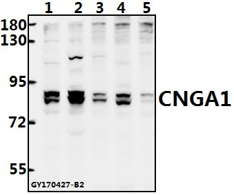 Western blot (WB) analysis of CNGA1 polyclonal antibody at 1:500 dilution
Lane1:CT26 whole cell lysate(40ug)
Lane2:PC12 whole cell lysate(40ug)
Lane3:EC9706 whole cell lysate(40ug)
Lane4:L02 whole cell lysate(40ug)