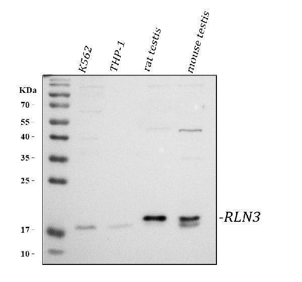  Western blot analysis of RLN3 using anti-RLN3 antibody (A05495-2)