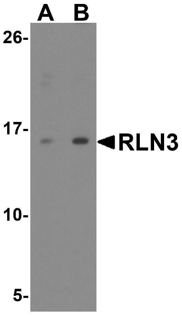 Western blot analysis of RLN3 in HeLa cell lysate with RLN3 antibody at (A) 1 and (B) 2 μg/ml