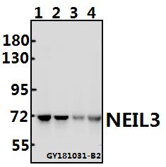 Western blot (WB) analysis of NEIL3 polyclonal antibody at 1:500 dilution
Lane1:MCF-7 whole cell lysate(40ug)
Lane2:H1792 whole cell lysate(40ug)
Lane3:The Thymus tissue lysate of Rat(40ug)
Lane4:The Testis tissue lysate of Mouse(40ug)