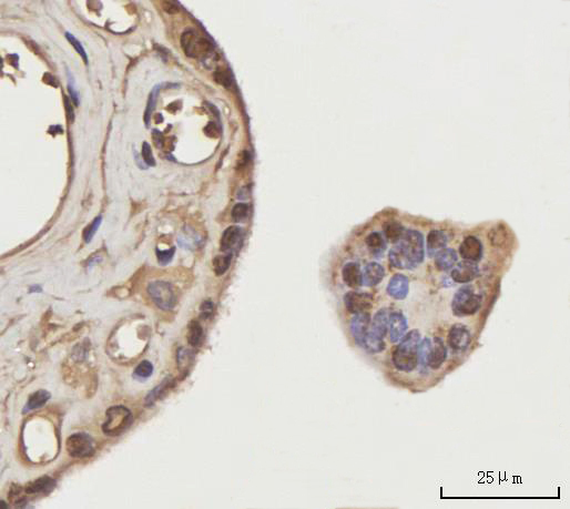  IHC analysis of NEIL3 using anti-NEIL3 antibody (A05497-4)