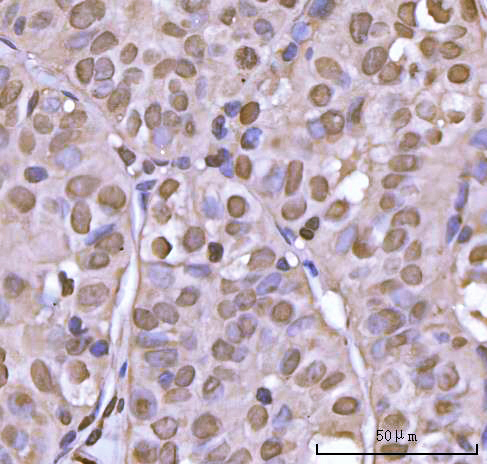  IHC analysis of NEIL3 using anti-NEIL3 antibody (A05497-4)
