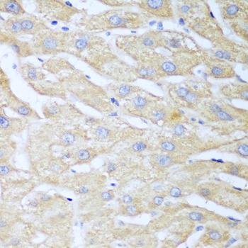 a05498 nudt15 primary antiboties ihc testing 2