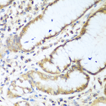 a05498 nudt15 primary antiboties ihc testing 3