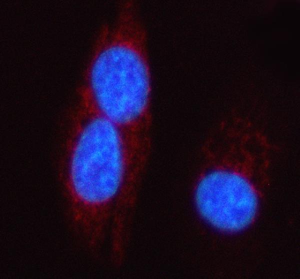 a05499 2 ftcd primary antibodies if testing 1
