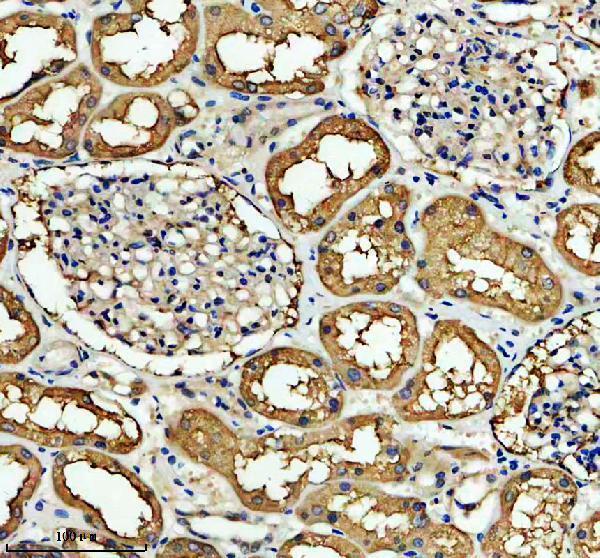 IHC analysis of FTCD using anti-FTCD antibody (A05499-2)
