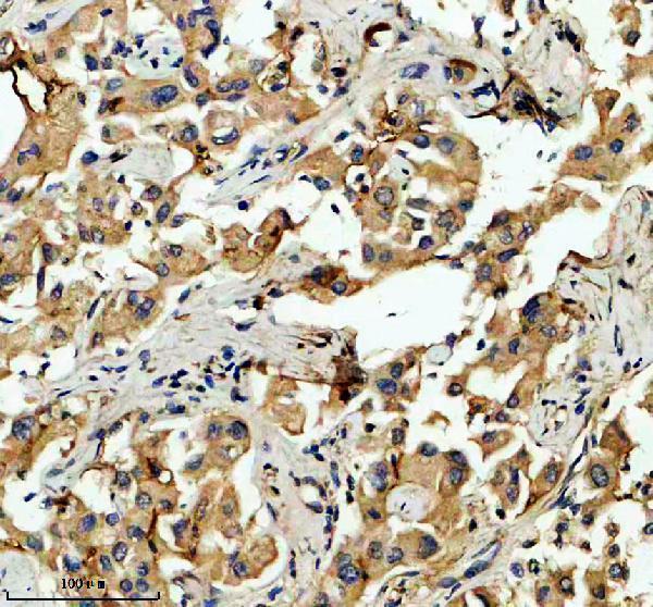IHC analysis of FTCD using anti-FTCD antibody (A05499-2)