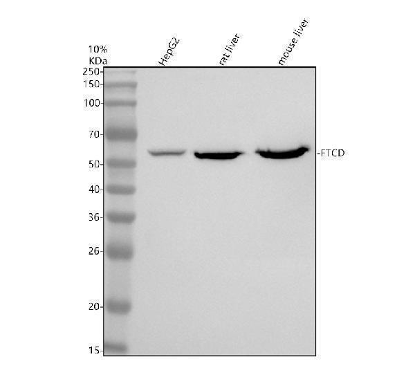 Western blot analysis of FTCD using anti-FTCD antibody (A05499-2)