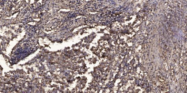 a05500 rab38 primary antibodies ihc testing 1