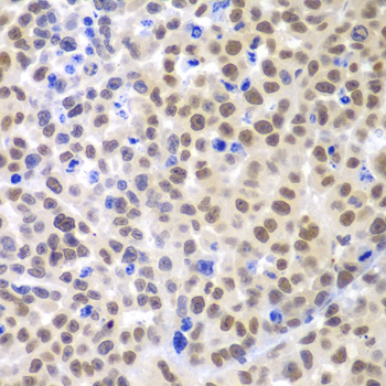 Immunohistochemistry of paraffin-embedded mouse cancer using LHX4 antibody  at dilution of 1:100 