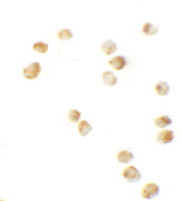 a05504 sptlc2 primary antibodies icc testing 6