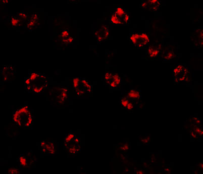 a05504 sptlc2 primary antibodies if testing 7