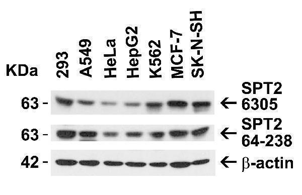 Independent Antibody Validation (IAV) via Protein Expression Profile in Human Cell Lines
Loading: 15 μg of lysates per lane