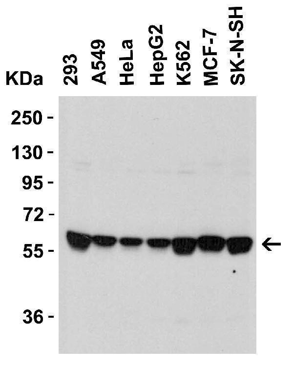 Western Blot Validation in Human Cell Lines
Loading: 15 μg of lysates per lane