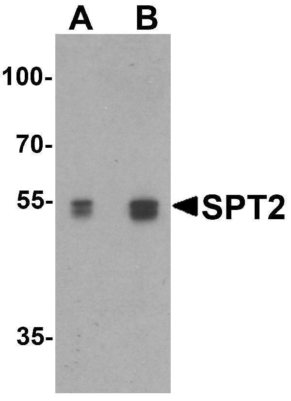 Western Blot Validation in Mouse 3T3 Cell Lysate in (A) the absence and (B) the presence of blocking peptide
Loading: 15 μg of lysates per lane