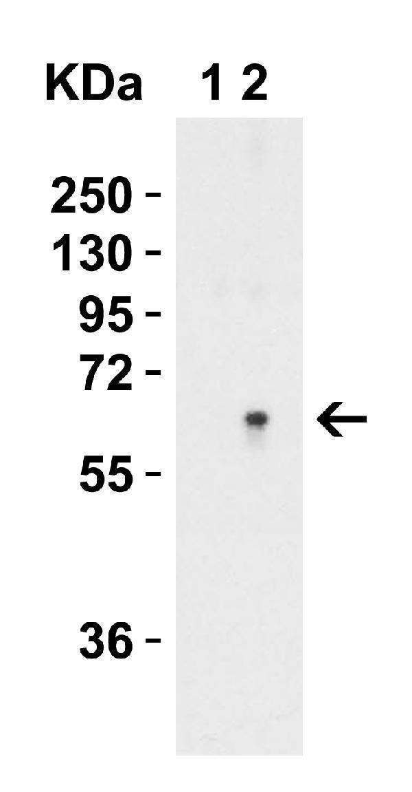 a05504 sptlc2 primary antibodies wb testing 4
