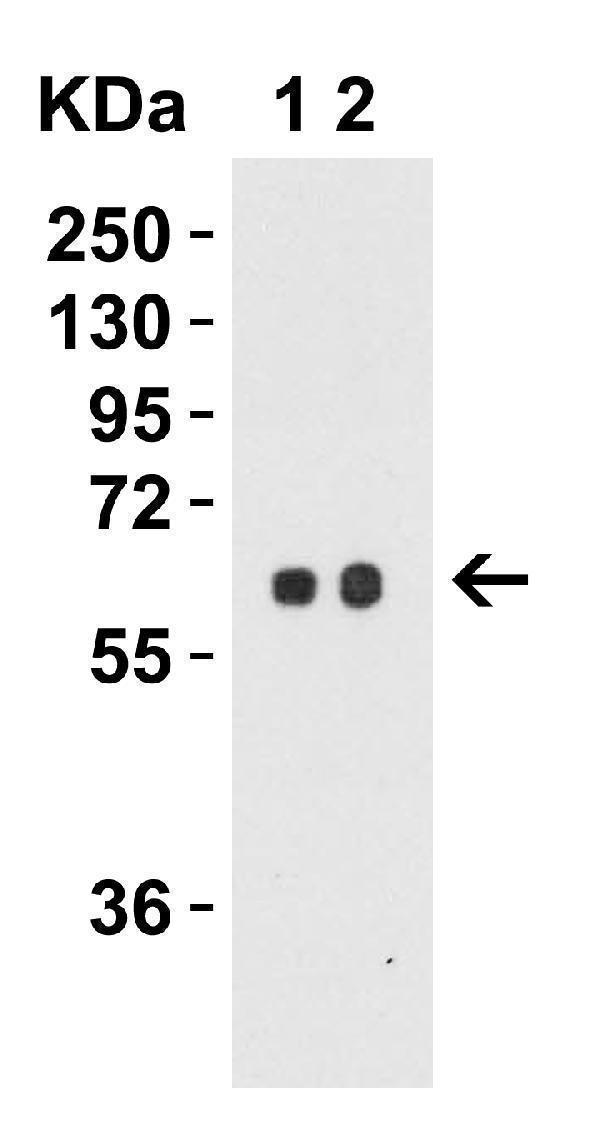 a05504 sptlc2 primary antibodies wb testing 5