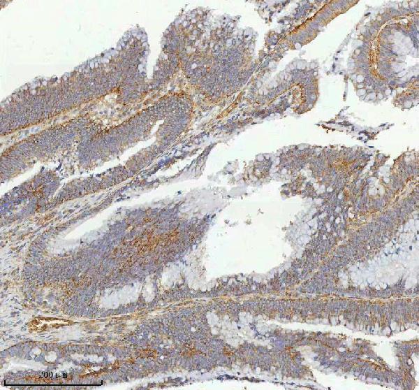 a05507 2 ist1 primary antibodies ihc testing 4