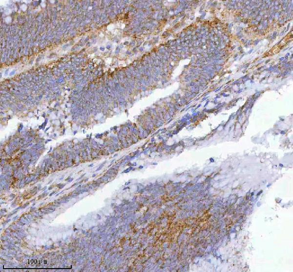 a05507 2 ist1 primary antibodies ihc testing 5